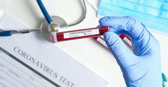 Aile Sağlığı Merkezlerinde Test Dönemi Başlayabilir