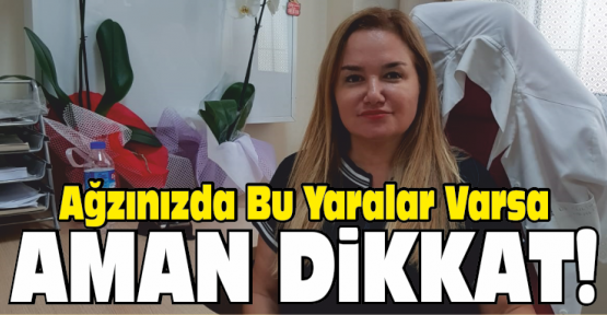 Akalın, Ağızdaki Yaralara Dikkat