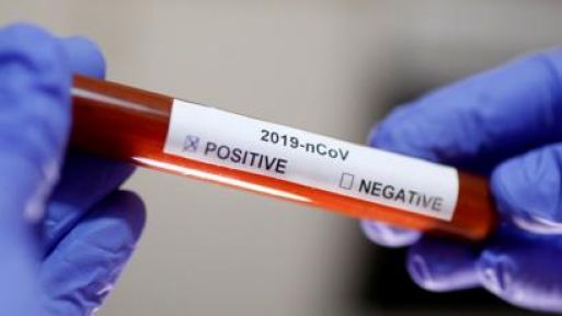 Koronavirüs Testinin Pozitif Çıktığını Açıkladı